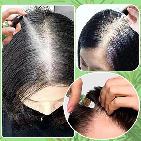 ⁦• rosemary hair care⁩ - الصورة ⁦4⁩